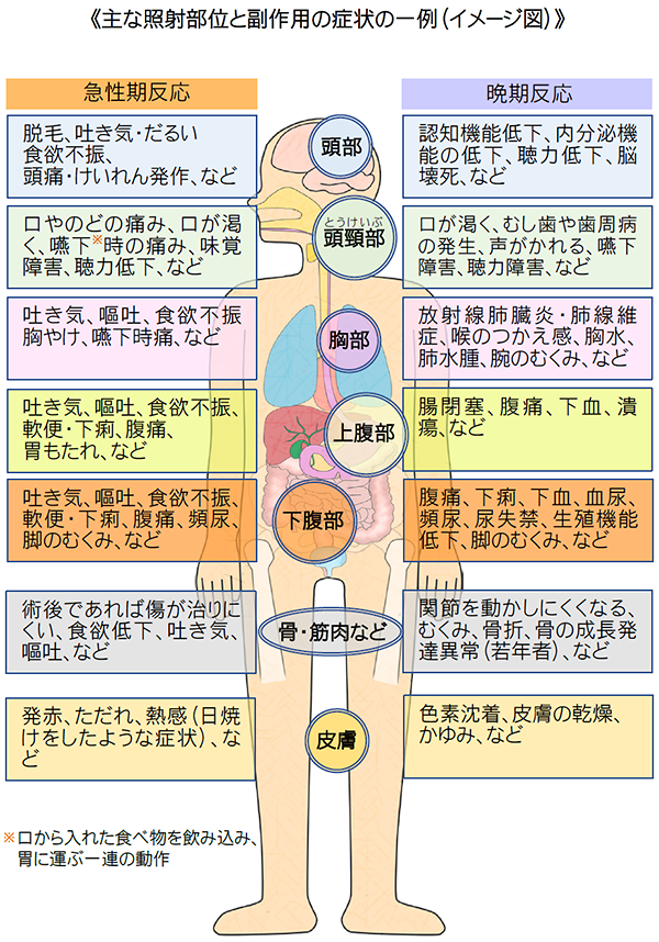 主な照射部位と副作用の症状の一例（イメージ図）